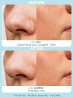 ماسك بديل جلسه هيدروفيشل و تنظيف عميق | Hydrafacial & Deep Cleansing Alternative Mask - Image 2